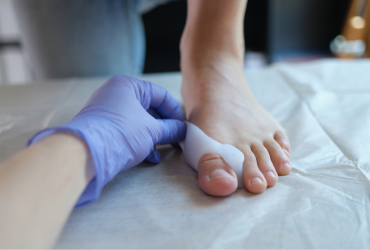 Managing Toe deformities